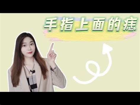 女生左手中指有痣|女生左手中指有痣是什么意思